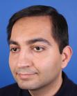 After Hair Transplant&nbsp;Front